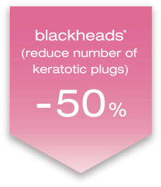 blackheads